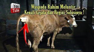 Waspada Rahim Meluntir, Kenali Gejala dan Begini Solusinya.