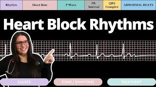 Heart Block Rhythms on an EKG with Qs | Circulatory System and Disease | NCLEX-RN | Nurse Cheung