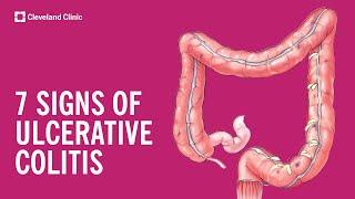 7 Warning Signs of Ulcerative Colitis