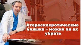 Атеросклеротические бляшки – можно ли их убрать?