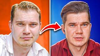 How I Grew My Hair Back Without A Hair Transplant