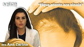 Entenda o que é a alopecia frontal fibrosante | Dra Ana Carina