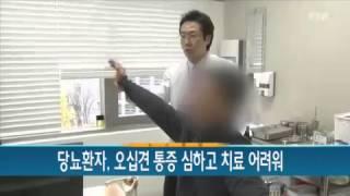 당뇨환자, 오십견 통증 심하고 치료 어려워 / YTN