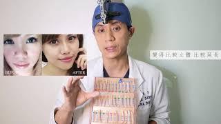 韓系鼻雕怎麼做？晶美整形外科陳啟傑院的Bistool挺鼻