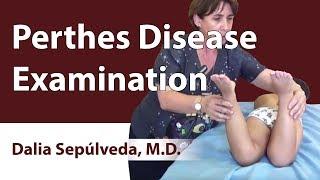 Perthes Disease Examination