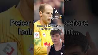 Peter Gulacsi hair transplant  #hairtransplant #football