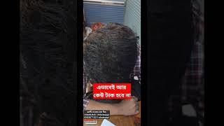বংশগত চুল পড়া বন্ধ হবেই । চুল পড়া কমানোর উপায়। How to reduce hairfall? Dr Mahamudul Islam Chowdhury