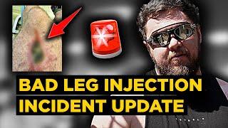 I almost had to amputate my leg... LEG INJECTION HORROR STORY During pfs/pssd/pas/plms Recovery