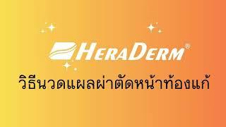 HeraDerm Thailand | การดูแลบาดแผล | วิธีนวดแผลผ่าตัดหน้าท้องแก้ 一┃〇