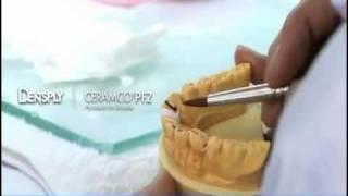 Dentsply Sirona Prident Video 1