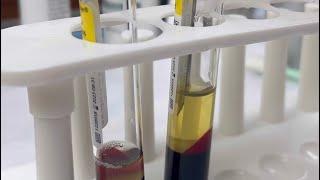 Pulling Plasma for a PRP #plasma #plateletrichplasma #prp #satisfying