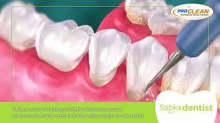 Teeth Cleaning + Polishing at Sabka Dentist | Combo Offer | ₹500/- only