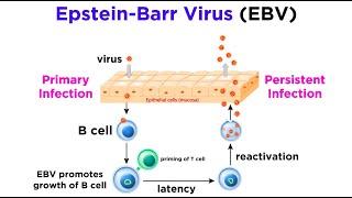 Mononucleosis (Epstein-Barr Virus)