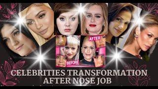 50 TOP CELEBRITIES NOSE JOB COMPILATION WITH AMAZING TRANSFORMATION I BEFORE AND AFTER I NEW TREND