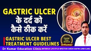 GASTRIC ULCER के दर्द को कैसे ठीक करें//GASTRIC ULCER BEST TREATMENT GUIDELINES