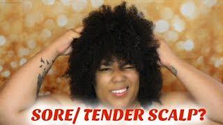 Sore/Tender Scalp? | My tips on how I treat it!