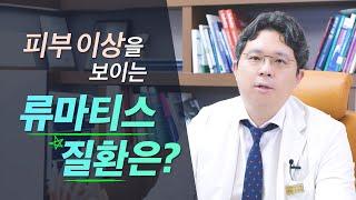 [류마티스내과]단순한 피부염으로 혼동될 수 있는 류마티스 질환?! l 길동류마티스내과