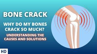 Bone Crack: The Science Behind the Popping Sounds