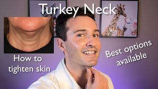 Turkey Neck : Best Tightening Treatments