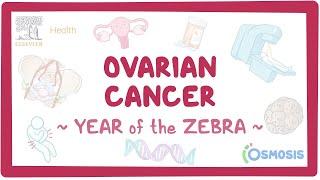 Ovarian cancer (Year of the Zebra)