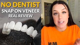 Snap On Removable Dental Veneers Review - The Best Alternative to $20,000 Cosmetic Dentistry!