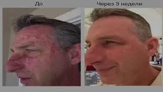 Jeunesse Global отзывы сыворотка Luminesce результаты применения Люминесс Компания Жанес Глобал