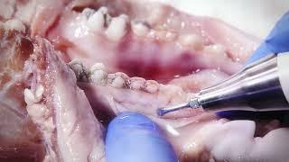 The Ultrasonics Series - Dentinal Tubules