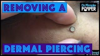"Popping Out"  a dermal piercing on the Right Cheek