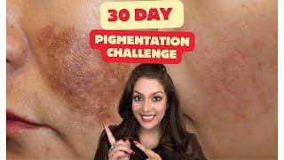 30 Day Pigmentation Challenge: How to Fade Dark Spots & Pigmentation at Home | Nipun Kapur