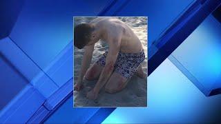 Miami-Dade employee runs over 3 sunbathing at Crandon Park beach