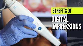 Digital Impressions (benefits of)