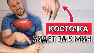 "Косточка" на большом пальце ноги уйдёт за 5 минут навсегда