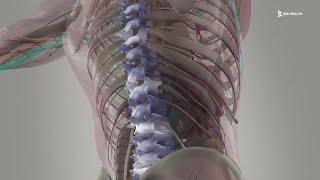 Pediatric Spine enabling Technology with Pediatric Orthopedics of SWFL