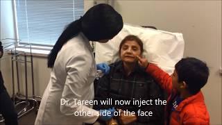 90 Second Facelift by Dr. Tareen