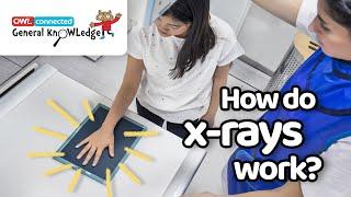 How do x-rays work? | General KnOWLedge