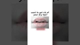 do you want to get rid for your dry lips?~#shorts#viral#lipscare #trending#glowup#fypシ#aesthetic