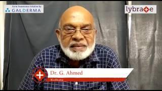 Lybrate | Dr. G Ahmed speaks on IMPORTANCE OF TREATING ACNE EARLY