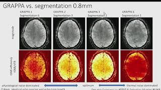 Data acquisition and analysis basics in layer-fMRI, Renzo Huber