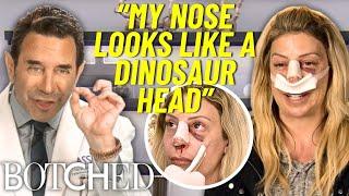 Dr. Nassif Transforms Jennifer's "Dinosaur" Nose *FULL TRANSFORMATION* | Botched | E!