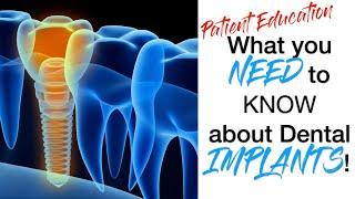 PATIENT EDUCATION - What you NEED to know about dental IMPLANTS!