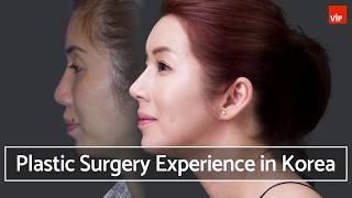 Plastic Surgery Experience in Korea