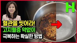 매일 이것만 하면 고지혈증 약 없이 사라집니다 건강한 혈관 만드는 가장 간단한 방법