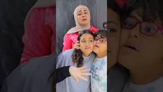 توأم ملتصق 