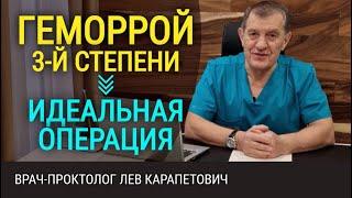 Геморрой 3-й степени. Какая операция лучше по удалению геморроя?