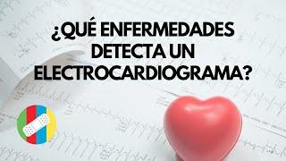 ¿Qué enfermedades detecta un electrocardiograma?