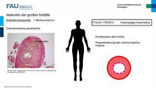 Rheumatologie ─ Vaskulitiden Teil 1/3