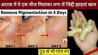 अदरक से झाइयां हटाने का कमाल का तरीका | Reduce Melasma, Pigmentation, Discolouration, Blackspots