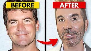 20 Celebrity Plastic Surgery Disasters