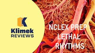 NCLEX PREP: VENTRICULAR RHYTHMS