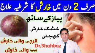 Kharish Ka ilaj | Kharish Khatam Karne Ka Tarika | خارش کا علاج | Harish Ka ilaj | Dr Shahbaz